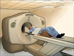 Có thể dùng PET Scan để phát hiện sớm ung thư không?