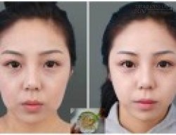 Trẻ ra 10 tuổi, da không 1 nếp nhăn chỉ cần sử dụng hỗn hợp này trong 1 tuần