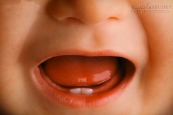 6 điều cần đặc biệt chú ý khi con thay răng