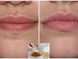 Có công thức này, bạn chẳng phải lo ria mép mọc lại nữa