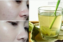 Làn da trắng căng mịn như gái Hàn nhờ xông mặt theo cách này 1 lần/tuần