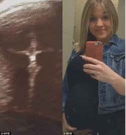 Bạn sẽ sốc khi biết mẹ bầu này thấy gì trong bức ảnh siêu âm thai nhi