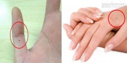Nốt ruồi trên tay ở vị trí nào tiết lộ tương lai giàu sang