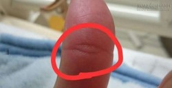 Vân mắt Phật trên ngón tay báo hiệu cả đời tài lộc, an nhiên