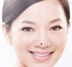 Phụ nữ giới tối kỵ nốt ruồi ở vị trí nào?