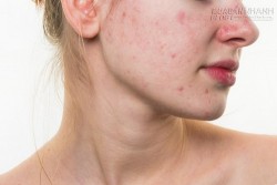 Triệu chứng của các bệnh cực kỳ nguy hiểm khi da xuất hiện 8 dấu hiệu này