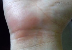 Những đặc điểm trên bàn tay chứng tỏ bạn thuộc diện ế bền vững
