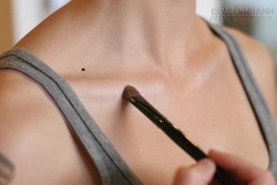 5 nốt ruồi hiểm độc huỷ hoại cả một đời