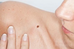 Chỉ điểm những nốt ruồi khiến khổ chủ mãi rước xui xẻo, phiền toái
