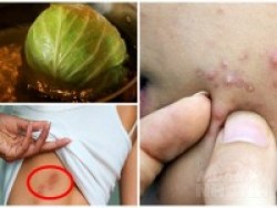 Kem đặc trị hay 10 triệu đi spa cũng thua xa 1001 công dụng làm đẹp kể mãi chẳng hết của 1 chiếc bắp cải