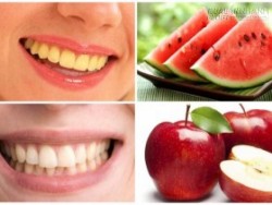 Mẹo làm trắng răng bằng trái cây, bạn đã biết chưa?