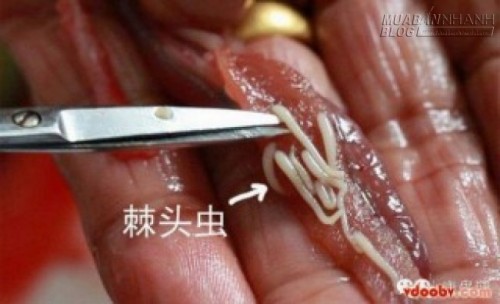 Rợn t&oacute;c g&aacute;y giun đầu gai l&uacute;c nh&uacute;c trong thực phẩm h&agrave;ng ng&agrave;y