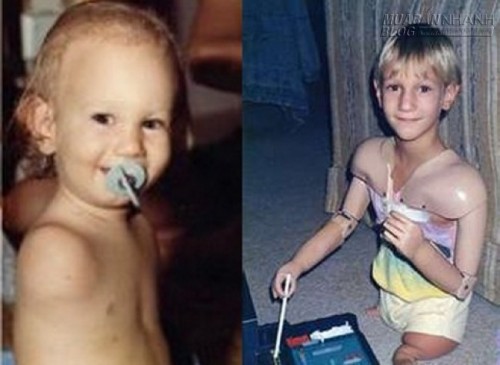 NICK VUJICIC - TỪ TUYỆT VỌNG ĐẾN Ý NGHĨA CUỘC ĐỜI