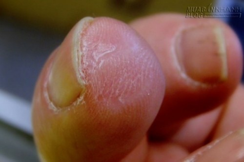 Nghiên cứu tái tạo cơ thể người từ... bàng quang loài heo