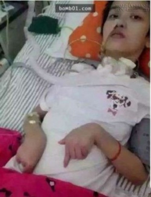 Cô gái trẻ xinh đẹp như hoa biến thành dị dạng sau một lần thổi nến sinh nhật