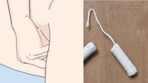 Tự phát hiện ung thư cổ tử cung chỉ bằng 1 chiếc tampon
