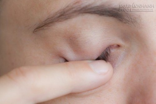Hàng nghìn người thoát khỏi cận thị, viễn thị nhờ kỹ thuật độc đáo này