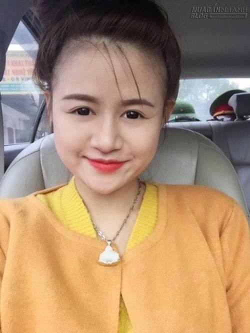 Công thức trị rạn da sau sinh đơn giản mà hiệu quả bất ngờ của một mẹ Việt