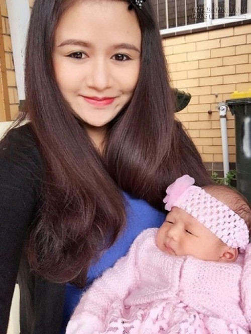 Công thức trị rạn da sau sinh đơn giản mà hiệu quả bất ngờ của một mẹ Việt