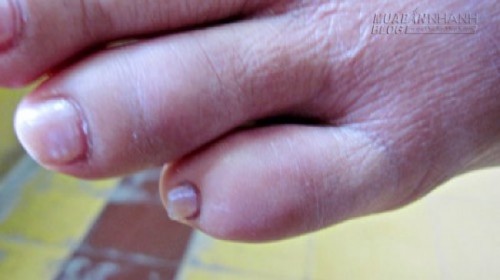 Thấy 1 trong 7 biểu hiện này thì bạn hãy tới bác sỹ ngay lập tức