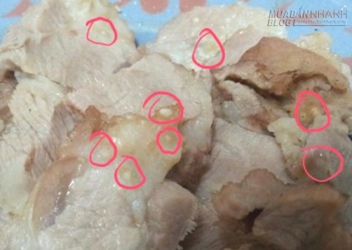 Dấu hiệu nhiễm sán dây lợn, biết muộn có thể viêm não, mù mắt!