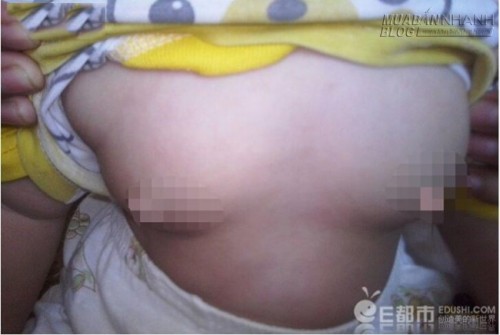 Cho con uống mật ong thường xuyên, mẹ té ngửa trước hậu quả khủng khiếp này