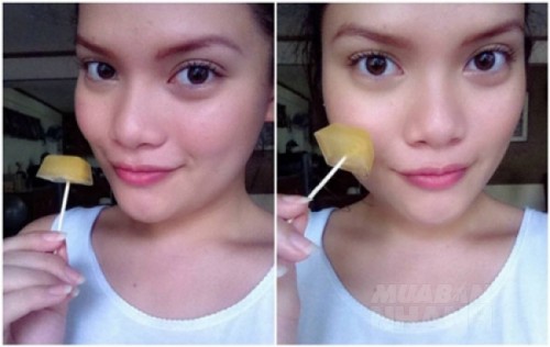 Xẹp mụn trứng c&aacute;, da l&aacute;ng mịn sau 1 đ&ecirc;m nhờ d&ugrave;ng thuốc nhỏ mắt c&oacute; b&aacute;n đầy tại c&aacute;c hiệu thuốc