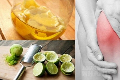 Mẹo đối ph&oacute; với bệnh khớp những ng&agrave;y r&eacute;t mướt