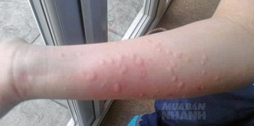 Loại nước 0 đồng m&agrave; da căng mịn, lỗ ch&acirc;n l&ocirc;ng se kh&iacute;t chẳng k&eacute;m thần dược, cứ d&ugrave;ng l&agrave; đẹp d&ugrave; bạn đ&atilde; 40 hay chỉ 20 tuổi