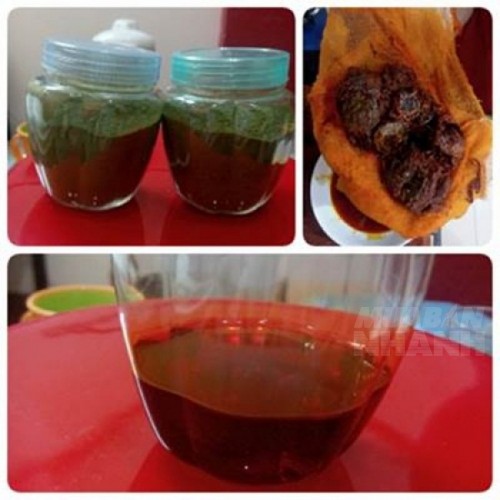 Sẹo th&acirc;m chi ch&iacute;t sẽ trắng b&oacute;c như g&aacute;i 18 nhờ chăm chỉ đắp thứ n&agrave;y 1 ph&uacute;t mỗi ng&agrave;y