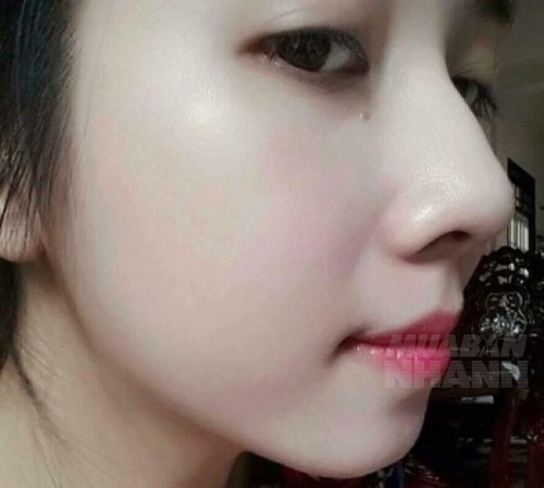 Ăn dứa liên tục trong 1 tuần và cái kết không thể ngọt ngào hơn, là con gái nhất định đừng bỏ qua
