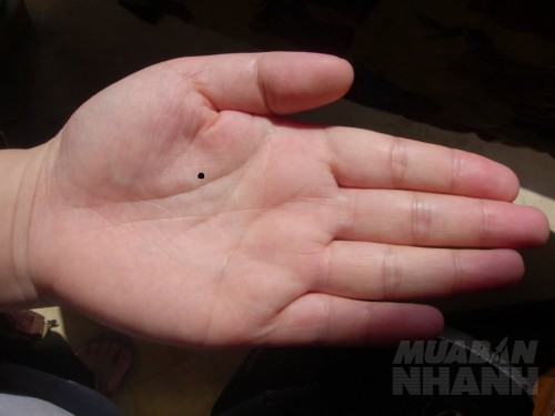 8 vị trí nốt ruồi trên tay nói lên điều gì?