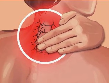 giảm mỏi cổ 1