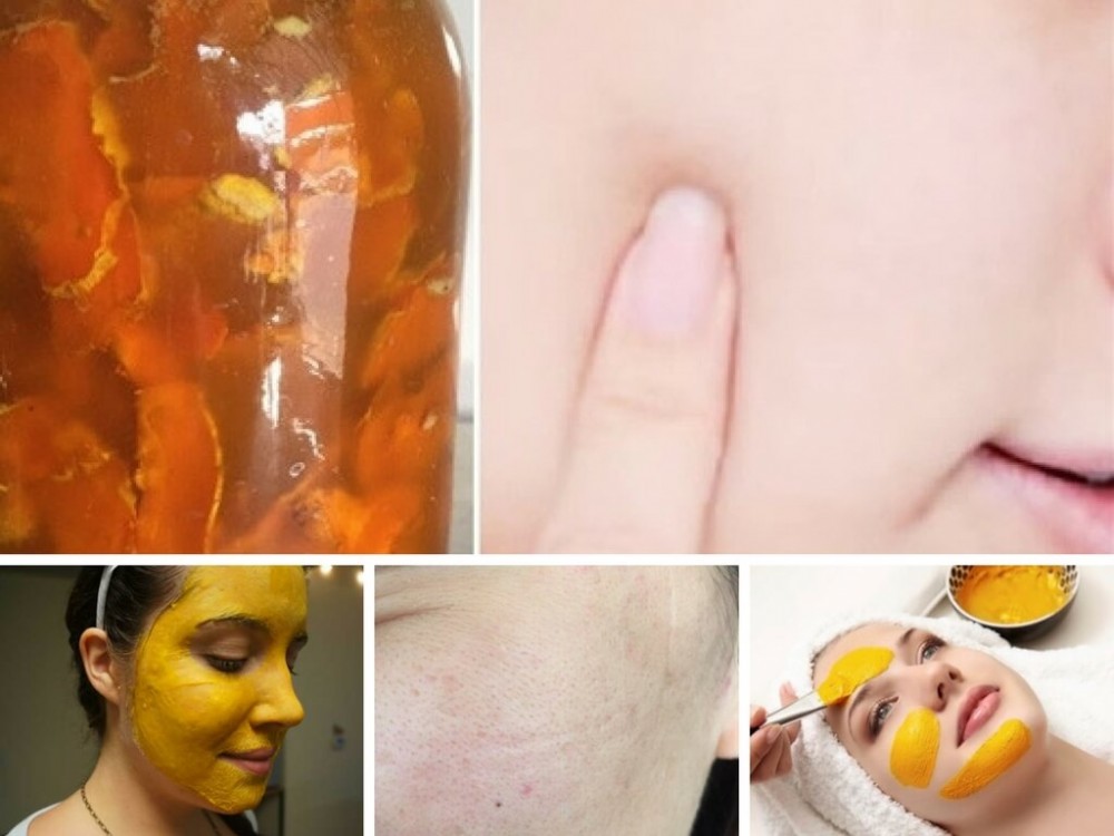Chăm sóc da bằng nghệ tươi