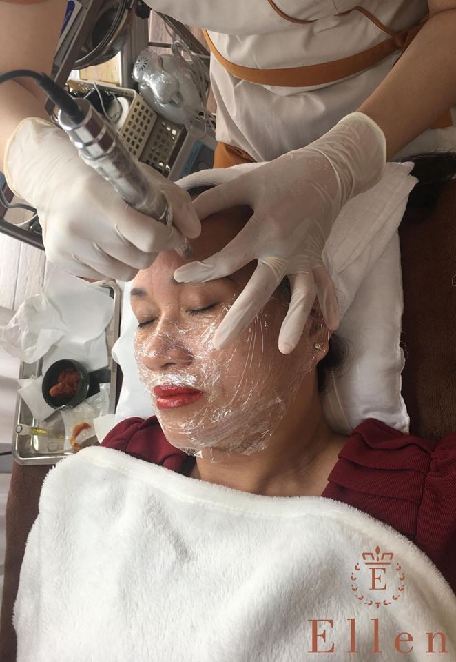 có nên đi nặn mụn ở spa làm đẹp không?