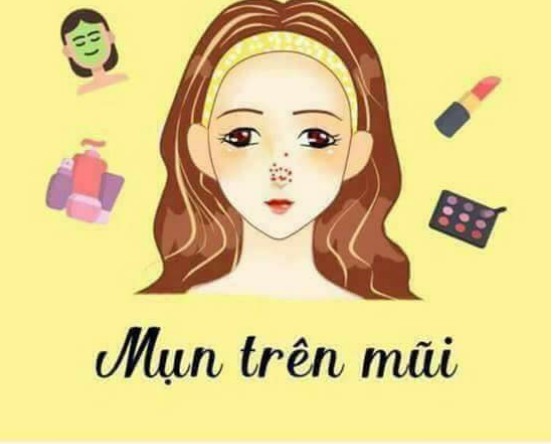 Chia sẽ: 12 vị trí của mụn cảnh báo sức khỏe của bạn