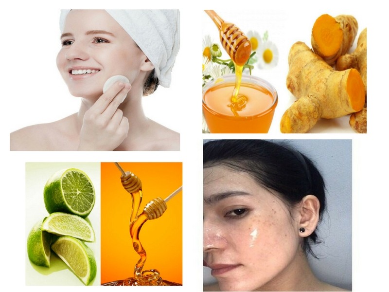 Cách trị mụn hiệu quả cho da dầu