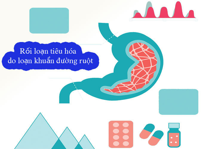 Biểu hiện rối loạn khuẩn đường ruột ở người lớn và cách điều trị
