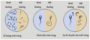 Người bị tinh trùng loãng có thể có con được không?