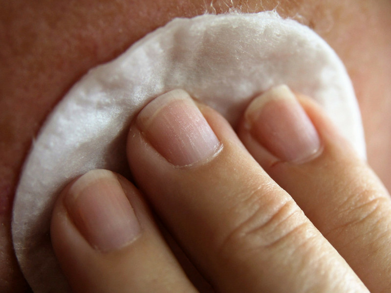 Thói quen tẩy lông có thể là một nguyên nhân gây nám da