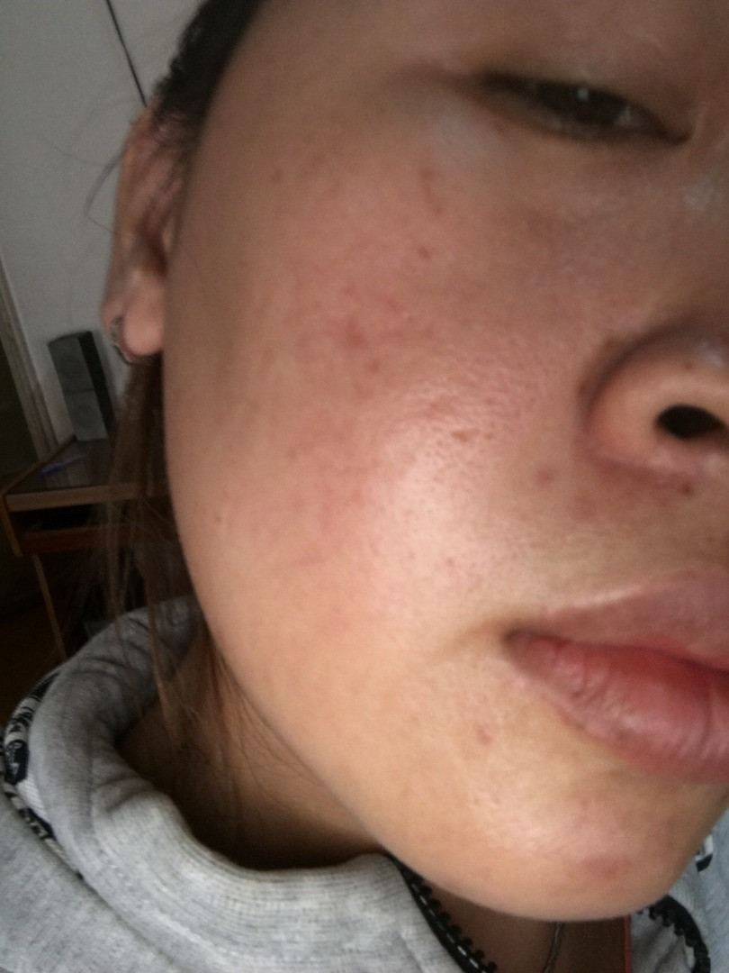 Tinh dầu bơ nguyên chất 100% - Sản phẩm làm đẹp được chị em tin dùng