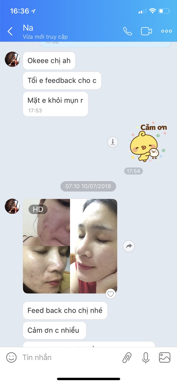 Kem Tichi Pháp trị nám da