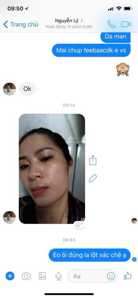 Kem Tichi Pháp trị nám da