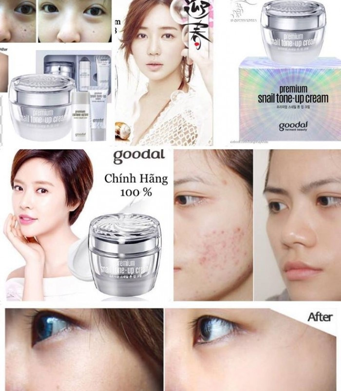 Lý do vì sao bạn nên chọn kem ốc sên Goodal?