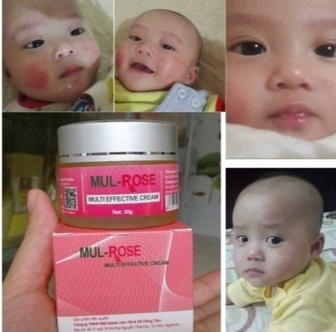 Hướng dẫn sử dụng kem Mul Rose(4)