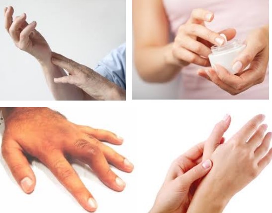 [Sức Khỏe] Đau đầu ngón tay là dấu hiệu của bệnh gì?