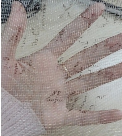 Thông tin kỹ thuật lưới chắn côn trùng