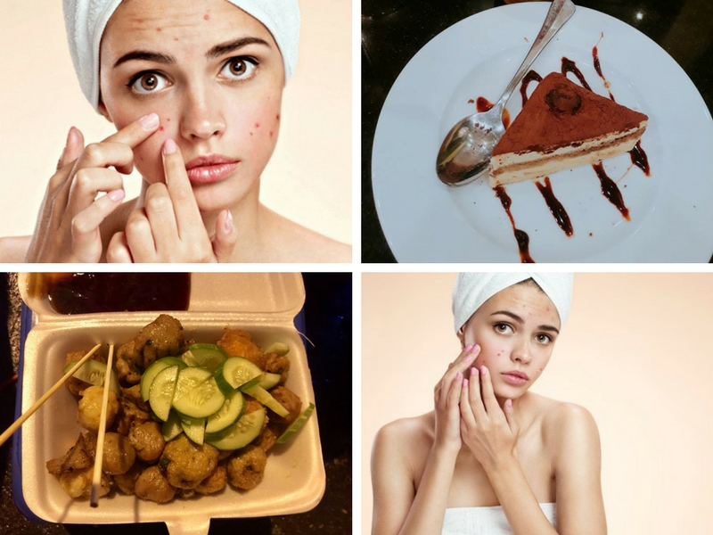 5 điều cần tránh khi da đang bị nổi mụn